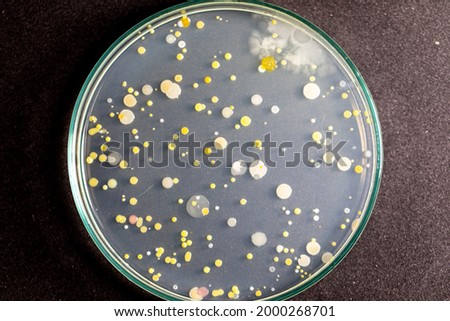 Backgrounds of Characteristics and Different shaped Colony of Bacteria and Mold growing on agar plates from Soil samples for education in Microbiology laboratory.
