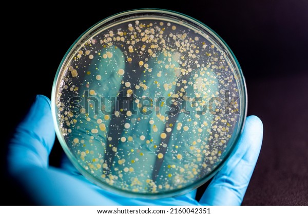 Backgrounds of Characteristics\
and Different shaped Colony of Bacteria and Mold growing on agar\
plates from Soil samples for education in Microbiology\
laboratory.
