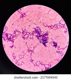 Bacteria Cell In Gram Stain Gram Positive Bacilli In Chain.