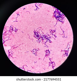 Bacteria Cell In Gram Stain Gram Positive Bacilli In Chain.