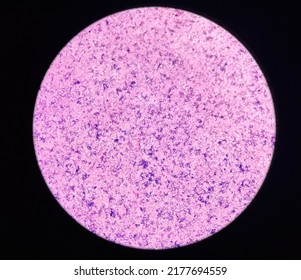 Bacteria Cell In Gram Stain Gram Positive Bacilli In Chain.