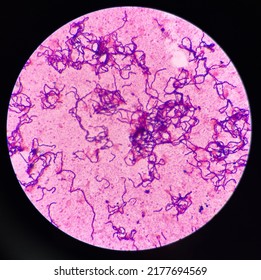 Bacteria Cell In Gram Stain Gram Positive Bacilli In Chain.