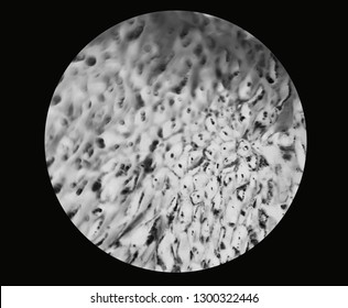 bacteria or cells under a microscope. Multiplication of bacteria or infection. Microbes Bacteria. attacking cells - Image
