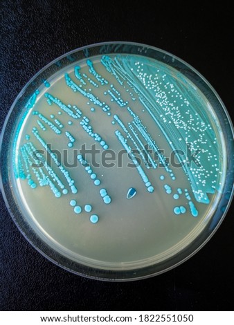 Bacteria in close-up. Listeria on Aloa media.
