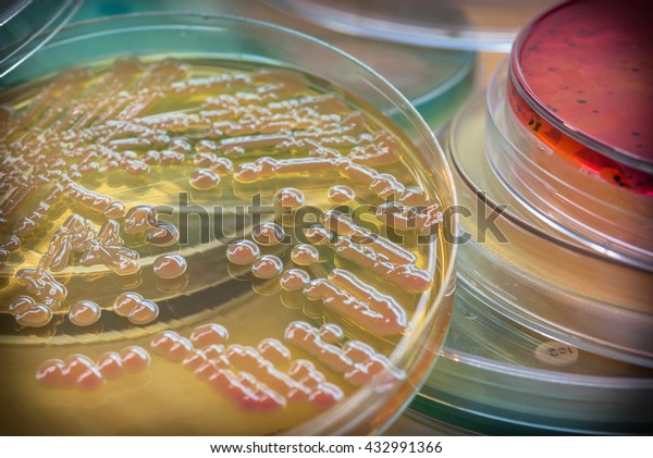 Bacteria colonies culture on MacConkey agar\
media(Klebsiella pneumoniae) contains small light grains. Focus on\
all agar surface. 