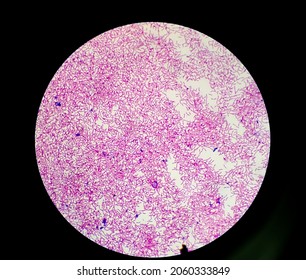 Bacteria colonies gram stain microscopic show escherichia coli, also known as E. coli, is a Gram-negative, facultative anaerobic, rod-shaped, coliform bacterium at medical laboratory. - Shutterstock ID 2060333849