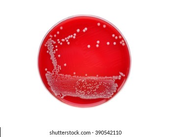Bacteria colony in blood agar medium culture plate

