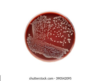 812 Pseudomonas aeruginosa Images, Stock Photos & Vectors | Shutterstock