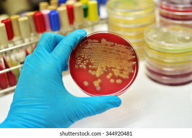 Bacteria colony in culture media plate