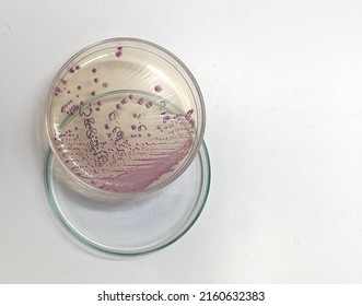 Bacteria Colony Of Escherichia Coli (E.coli) In Culture Media Plate, Hichrome UTI Agar Media, White Background