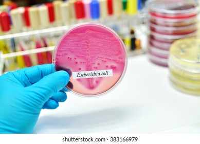 Bacteria Colony Of Escherichia Coli (E.coli) In Culture Media Plate