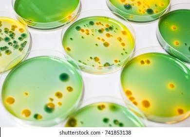 Bacteria  Culture For Vibrio Parahaemolyticus, Negative Bacteria.