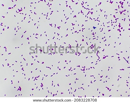 Bacteria Enterococcus isolated on white background micrograph. Gram-positive cocci which cause infant endocarditis and other infections
