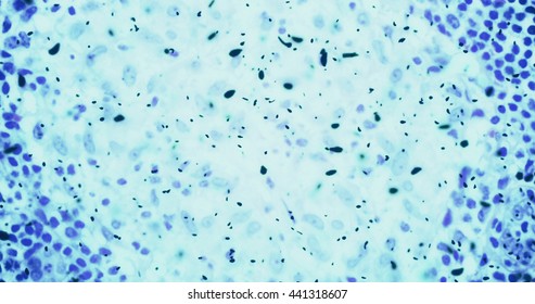 bacteria or germs microorganism cells under microscope in the color chemical blue fluid, slowing movement - Powered by Shutterstock