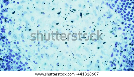 bacteria or germs microorganism cells under microscope in the color chemical blue fluid, slowing movement