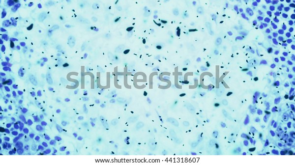 細菌或細菌微生物細胞在顯微鏡下的顏色化學藍色液體 減緩運動庫存照片 立刻編輯