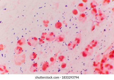 Bacteria Gram Positive Sputum Gram Stainlaboratory Stock Photo ...