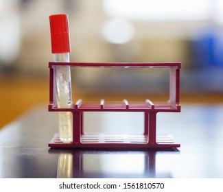 Bacteria Growing On An Agar Slant.