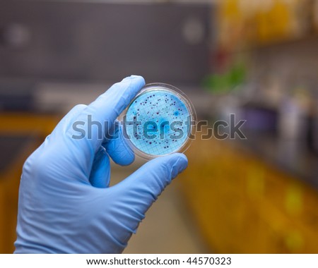 Bacteria growing on a petri dish.