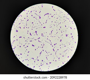 Bacteria Methicillin-resistant Staphylococcus Aureus MRSA, Multidrug Resistant Bacteria, On Surface Of Skin Or Mucous Membrane. Microscopic Zooming Image Of Pure Culture Colonies Gram Stained.