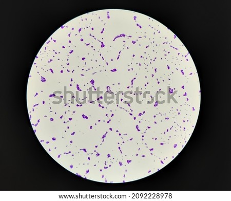 Bacteria methicillin-resistant Staphylococcus aureus MRSA, multidrug resistant bacteria, on surface of skin or mucous membrane. Microscopic Zooming image of pure culture colonies gram stained.