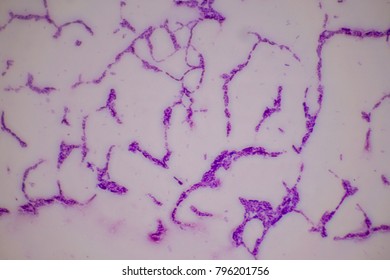 spirilla bacteria under microscope