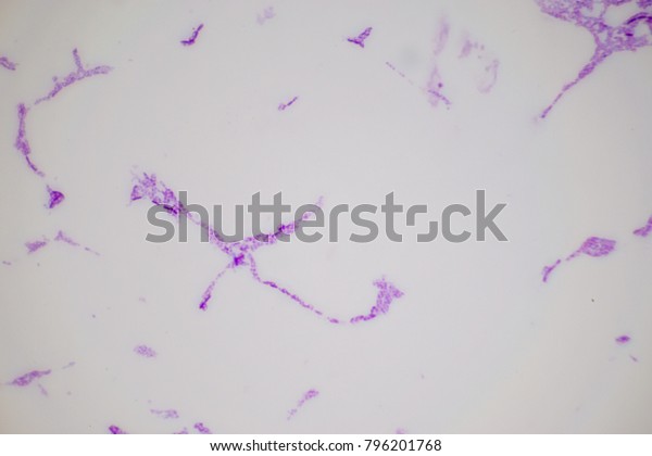 spirilla bacteria under microscope