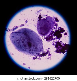 Bacteria In Specimen Sputum Gram Stain Test Fine Of Microscope.