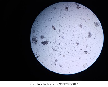 bacteria under the microscope . 