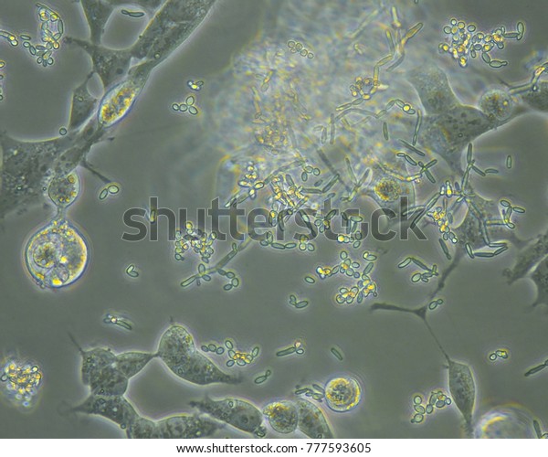 Bacteria Yeast Fungus Contamination Cell Culture Stock Photo (Edit Now