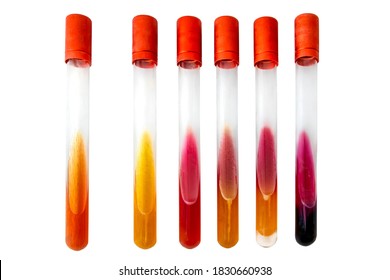 
Bacterial Biochemical Identification tests in tubes with slant medium. Microbiology examination isolated o white background.