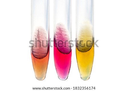 Bacterial Biochemical Identification tests in tubes with slant medium. Microbiology examination isolated o white background.
