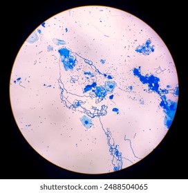 Bacterial cells chains 