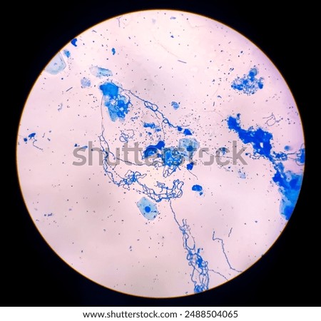 Bacterial cells chains 