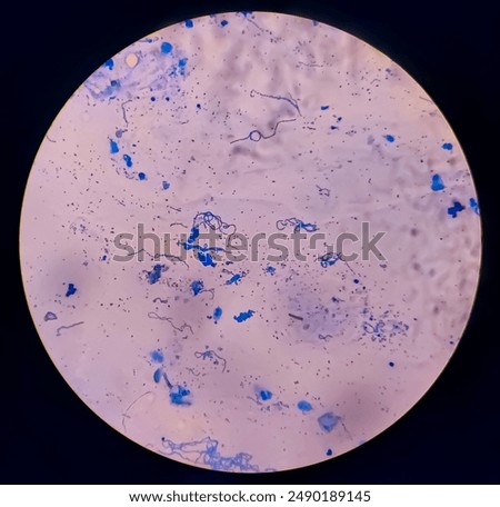 Bacterial cells chains 