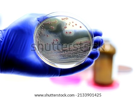 Bacterial colonies of the bacterium Methicillin-resistant Staphylococcus aureus (MRSA) growing on a microbiological chromogenic medium 