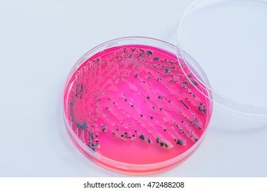 78 Xylose test Images, Stock Photos & Vectors | Shutterstock