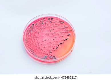 78 Xylose test Images, Stock Photos & Vectors | Shutterstock