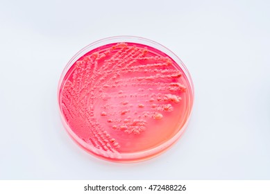 78 Xylose test Images, Stock Photos & Vectors | Shutterstock