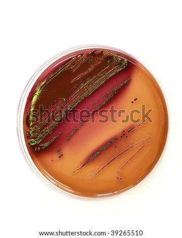 Bacterial colonies growing on an agar plate.