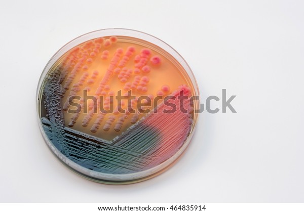 Bacterial Culture Growth On Macconkey Agar Stock Photo 464835914 ...