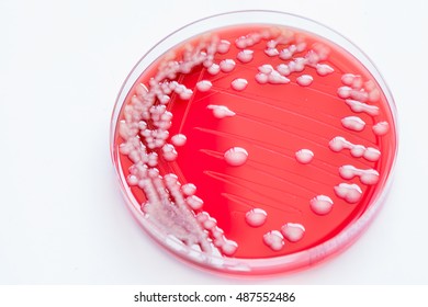 180 Fecal culture Images, Stock Photos & Vectors | Shutterstock