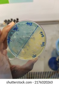 Bacterial Growth On CLED AGAR Plate