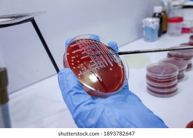 Bacterial Growth On Culture Agar Plate