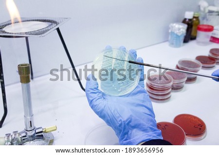 Bacterial growth on culture agar plate