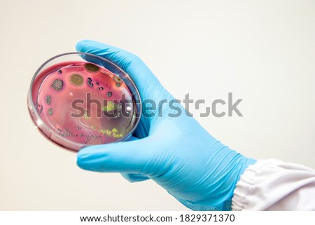bacterial infection (Escherichia coli ) analyzes microorganisms growth in petri dish at laboratory. Medical tests in laboratory research disease outbreak control prevention.