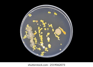 Bacterial load in food handlers. Bacteria in human hair. Bacteria in human beard. Personal hygiene test. Swab test in hair. Swab test in beard. Bacteria in hair. Bacteria in beard.  - Powered by Shutterstock