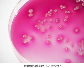 Bacterial Pathogen Escherichia Coli E Coli Stock Photo (Edit Now ...