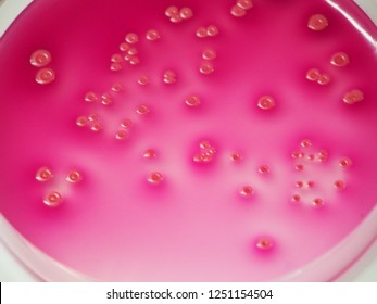 Bacterial pathogen, Escherichia coli or E. coli growing on selective agar on the microbiology laboratory desk 
