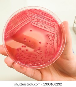 Bacterial pathogen, Escherichia coli or E. coli growing on selective agar on the microbiology laboratory showing bright pinky colonies.